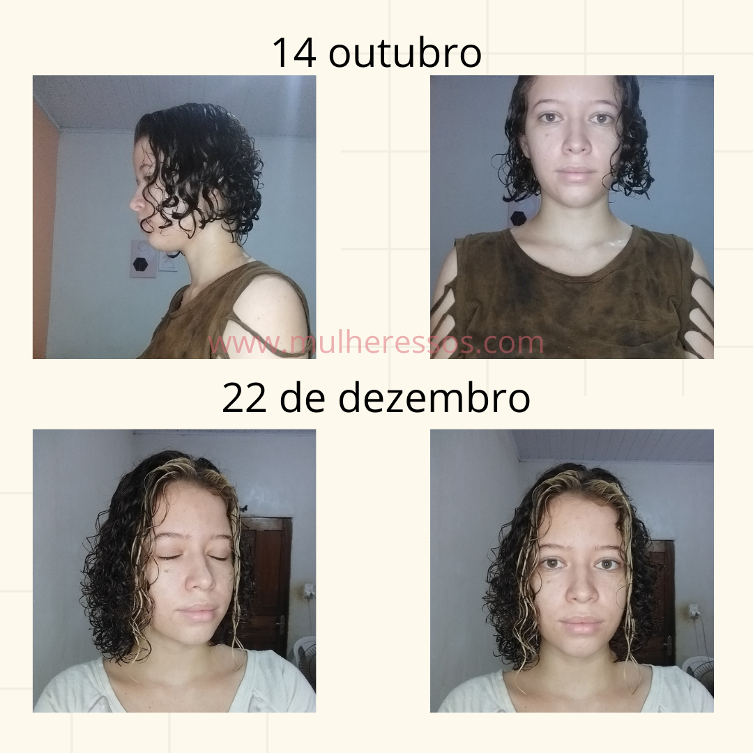 1 mês usando as gomas capilar da Imunehair
 Resenha com antes e depois